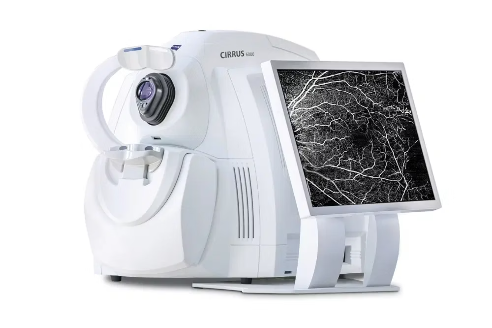 OCT Angiography: retinal blood-flow imaging without routine dye injection
